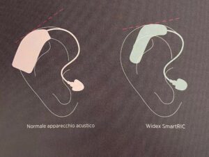 due orecchie con apparecchi acustici, viene indicato il posizionamento differente tra i due prodotti